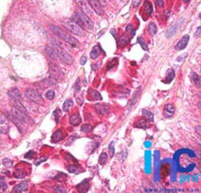 Immunohistochemistry-Paraffin: AMBRA1 Antibody [NBP2-24723]