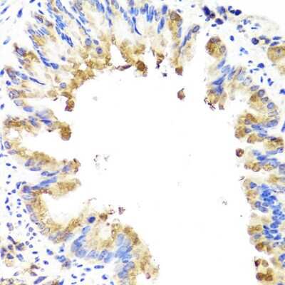 Immunohistochemistry-Paraffin: AMBRA1 Antibody - BSA Free [NBP2-92849]