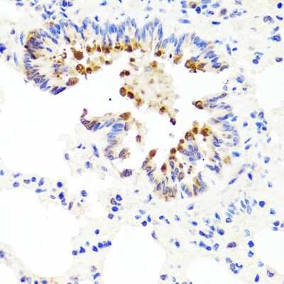 Immunohistochemistry-Paraffin: AMBRA1 Antibody - BSA Free [NBP2-92849]