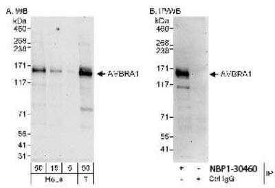 Western Blot: AMBRA1 Antibody [NBP1-30460]