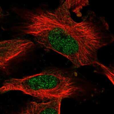 Immunocytochemistry/ Immunofluorescence: AMD1 Antibody [NBP1-87094]