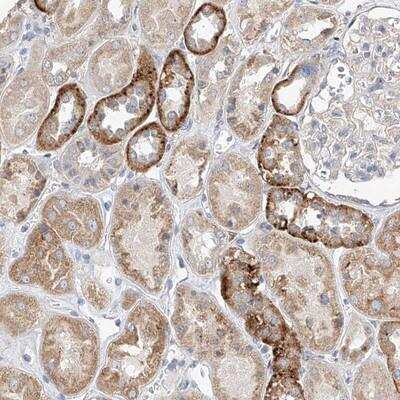 Immunohistochemistry-Paraffin: AMD1 Antibody [NBP1-87093]