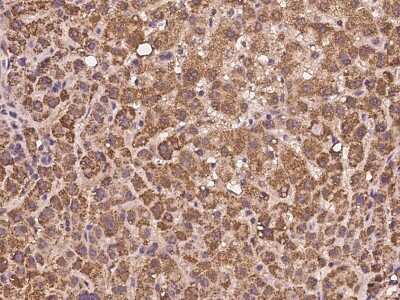 Immunohistochemistry-Paraffin: AMD1 Antibody [NBP2-97180]