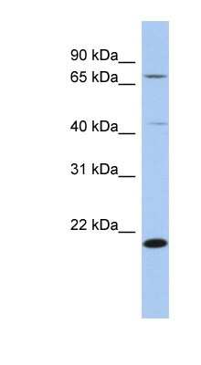 Western Blot: AMD1 Antibody [NBP1-54975]