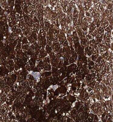 Immunohistochemistry-Paraffin: AMDHD1 Antibody [NBP1-82701]