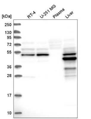 Western Blot: AMDHD1 Antibody [NBP1-82701]