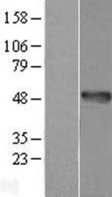 Western Blot: AMDHD1 Overexpression Lysate [NBL1-07497]