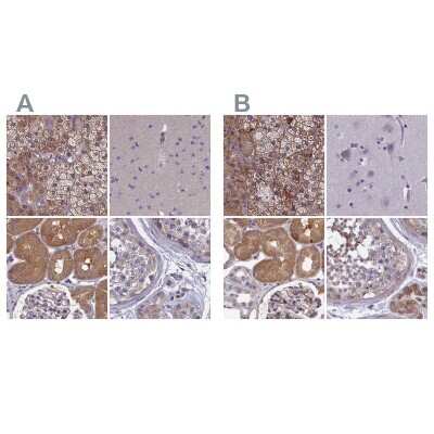 Immunohistochemistry-Paraffin: AMDHD2 Antibody [NBP1-84515]