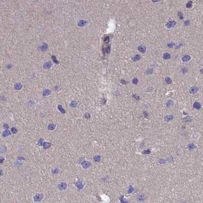 Immunohistochemistry-Paraffin: AMDHD2 Antibody [NBP1-84515]