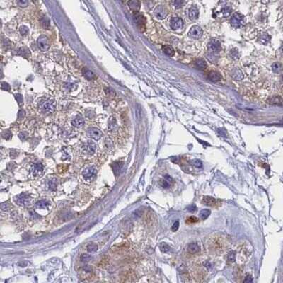 Immunohistochemistry-Paraffin: AMDHD2 Antibody [NBP1-84515]