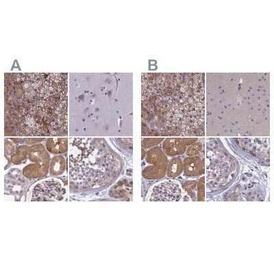 Immunohistochemistry-Paraffin: AMDHD2 Antibody [NBP1-84516]