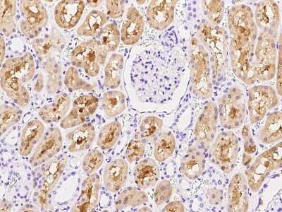 Immunohistochemistry-Paraffin: AMDHD2 Antibody [NBP2-99173]