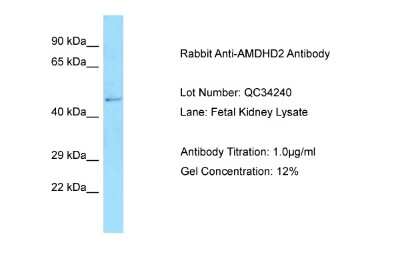 Western Blot: AMDHD2 Antibody [NBP2-86991]