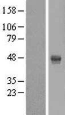 Western Blot: AMDHD2 Overexpression Lysate [NBL1-07498]