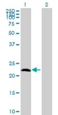 Western Blot: AMELX Antibody [H00000265-B01P]