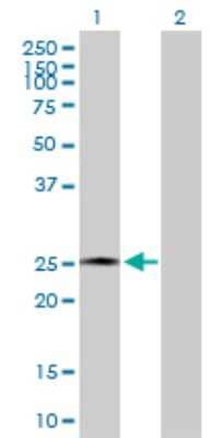 Western Blot: AMELX Antibody [H00000265-D01P]