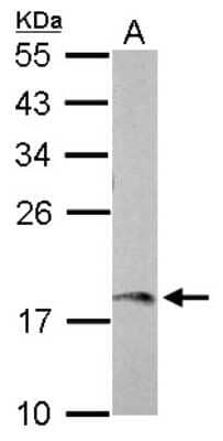 Western Blot: AMELX Antibody [NBP2-15373]