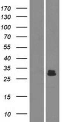 Western Blot: AMELX Overexpression Lysate [NBP2-04831]