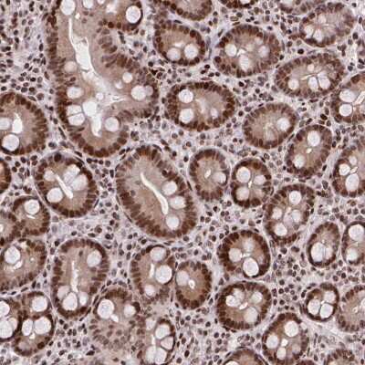 Immunohistochemistry: WTX Antibody [NBP2-49437]