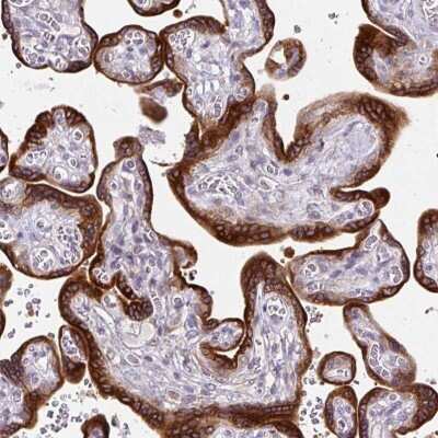 Immunohistochemistry-Paraffin: AMFR/gp78 Antibody [NBP2-33917]