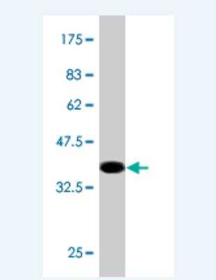 Western Blot: AMFR/gp78 Antibody (3D9) [H00000267-M01]