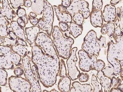Immunohistochemistry-Paraffin: AMFR/gp78 Antibody [NBP2-97986]