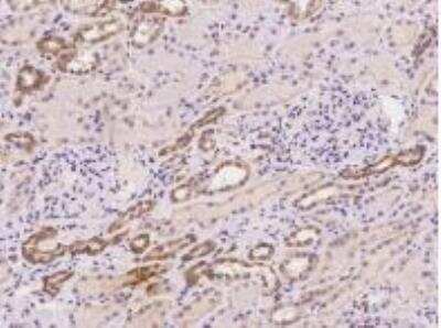 Immunohistochemistry-Paraffin: AMFR/gp78 Antibody [NBP2-97986]