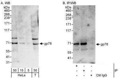 Western Blot: AMFR/gp78 Antibody [NBP1-49986]