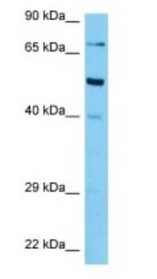 Western Blot: AMFR/gp78 Antibody [NBP3-10831]