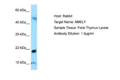 Western Blot: AMGL Antibody [NBP1-98264]