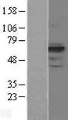 Western Blot: MIS RII/AMHR2 Overexpression Lysate [NBL1-07499]