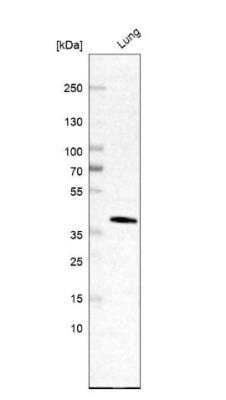 Western Blot: AMICA/JAML Antibody [NBP2-14286]