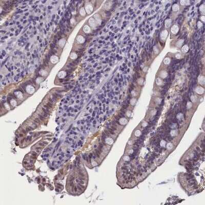 Immunohistochemistry-Paraffin: AMID Antibody [NBP1-90176]
