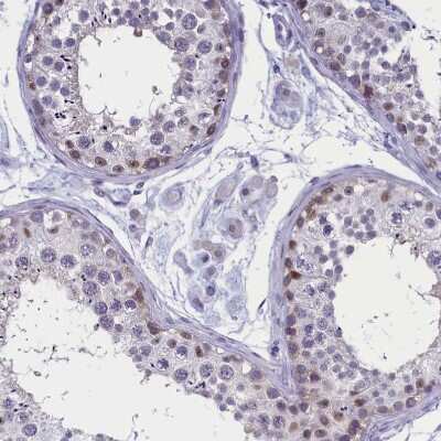 Immunohistochemistry-Paraffin: AMID Antibody [NBP1-90176]