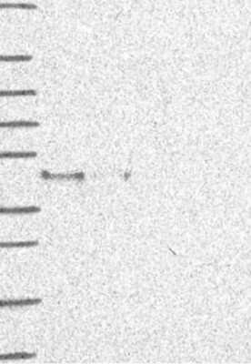 Western Blot: AMID Antibody [NBP3-17800]