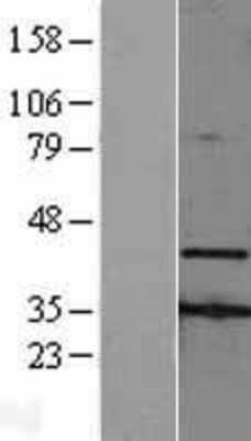 Western Blot: AMID Overexpression Lysate [NBL1-07411]