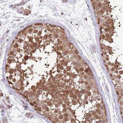 Immunohistochemistry-Paraffin: AMIGO Antibody [NBP2-14287]