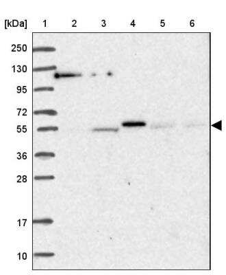 Western Blot: AMIGO Antibody [NBP2-14287]