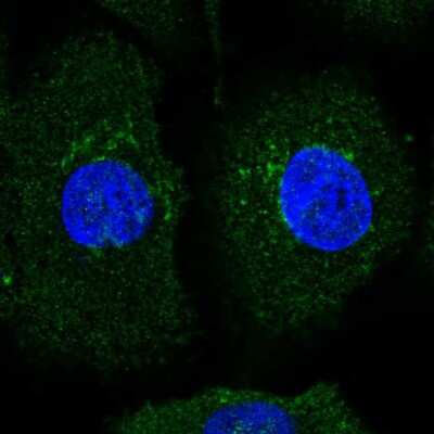 Immunocytochemistry/ Immunofluorescence: AMIGO2 Antibody [NBP2-56648]