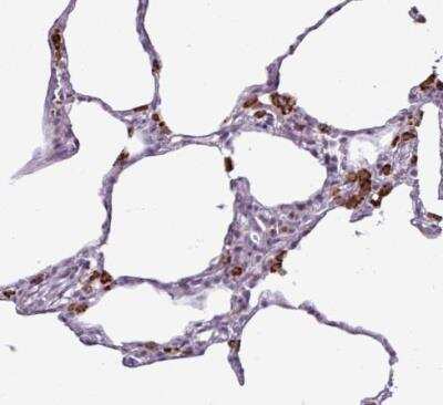 Immunohistochemistry-Paraffin: AMIGO2 Antibody [NBP2-14288]