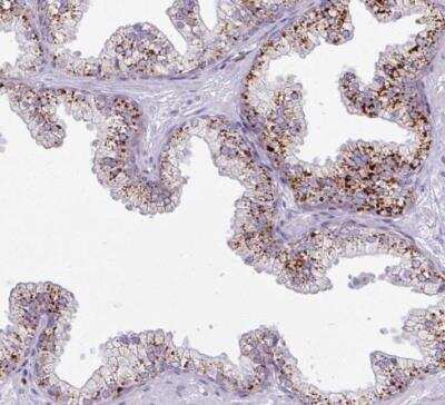 Immunohistochemistry-Paraffin: AMIGO2 Antibody [NBP2-14288]