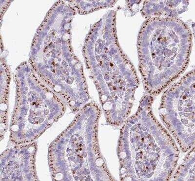 Immunohistochemistry-Paraffin: AMIGO2 Antibody [NBP2-14288]