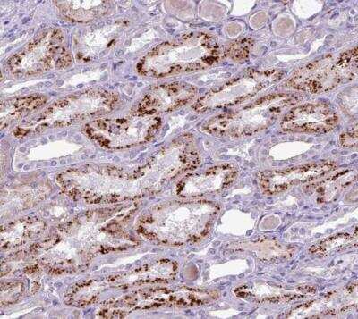 Immunohistochemistry-Paraffin: AMIGO2 Antibody [NBP2-14288]