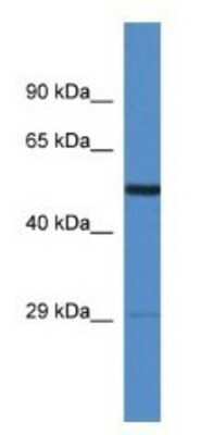 Western Blot: AMIGO2 Antibody [NBP1-79603]