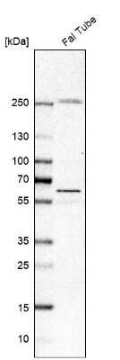 Western Blot: AMIGO2 Antibody [NBP2-14288]