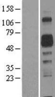 Western Blot: AMIGO2 Overexpression Lysate [NBL1-07501]