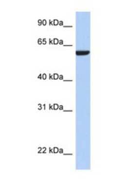 Western Blot: AMIGO3 Antibody [NBP1-69480]