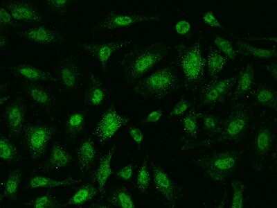 Immunocytochemistry/ Immunofluorescence: AMMECR1 Antibody [NBP2-97342]