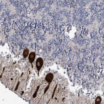 Immunohistochemistry-Paraffin: AMMECR1 Antibody [NBP2-14289]