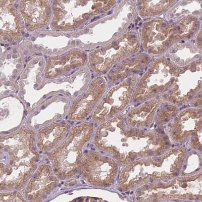 Immunohistochemistry-Paraffin: AMMECR1 Antibody [NBP2-55138]
